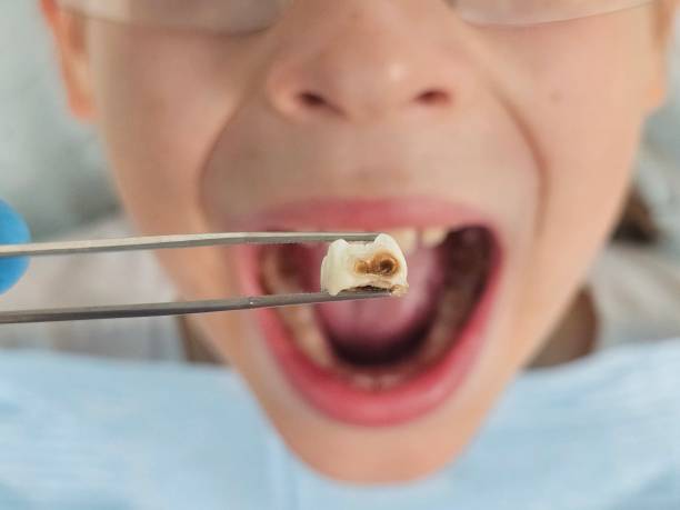 Best Tooth Pain Emergency Relief  in Federal Y, WA