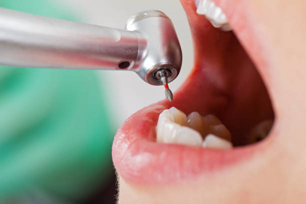 Best Tooth Pain Emergency Relief  in Federal Y, WA